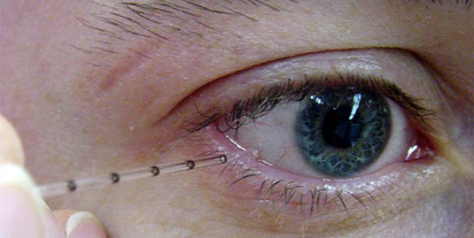 Taking tear samples — that#39;s Images Of Eyes With Tears. Taking tear samples — that#39;s